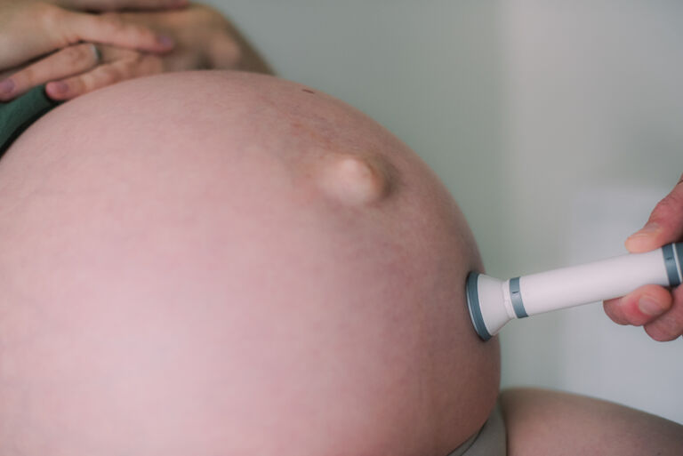 Echo of doptone op de buik van een zwangere vrouw