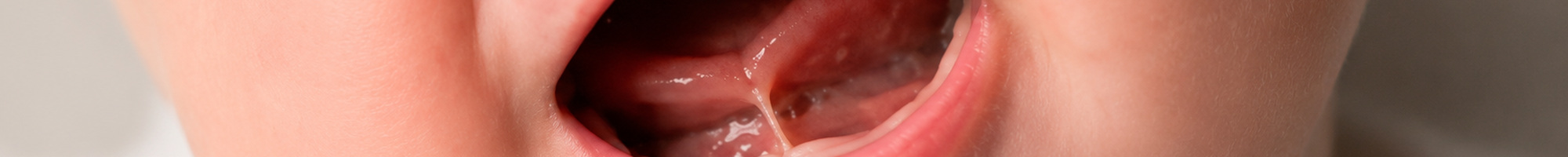 tongriem-banner-2000x200 Close-up van de mond van een baby met de tong zichtbaar